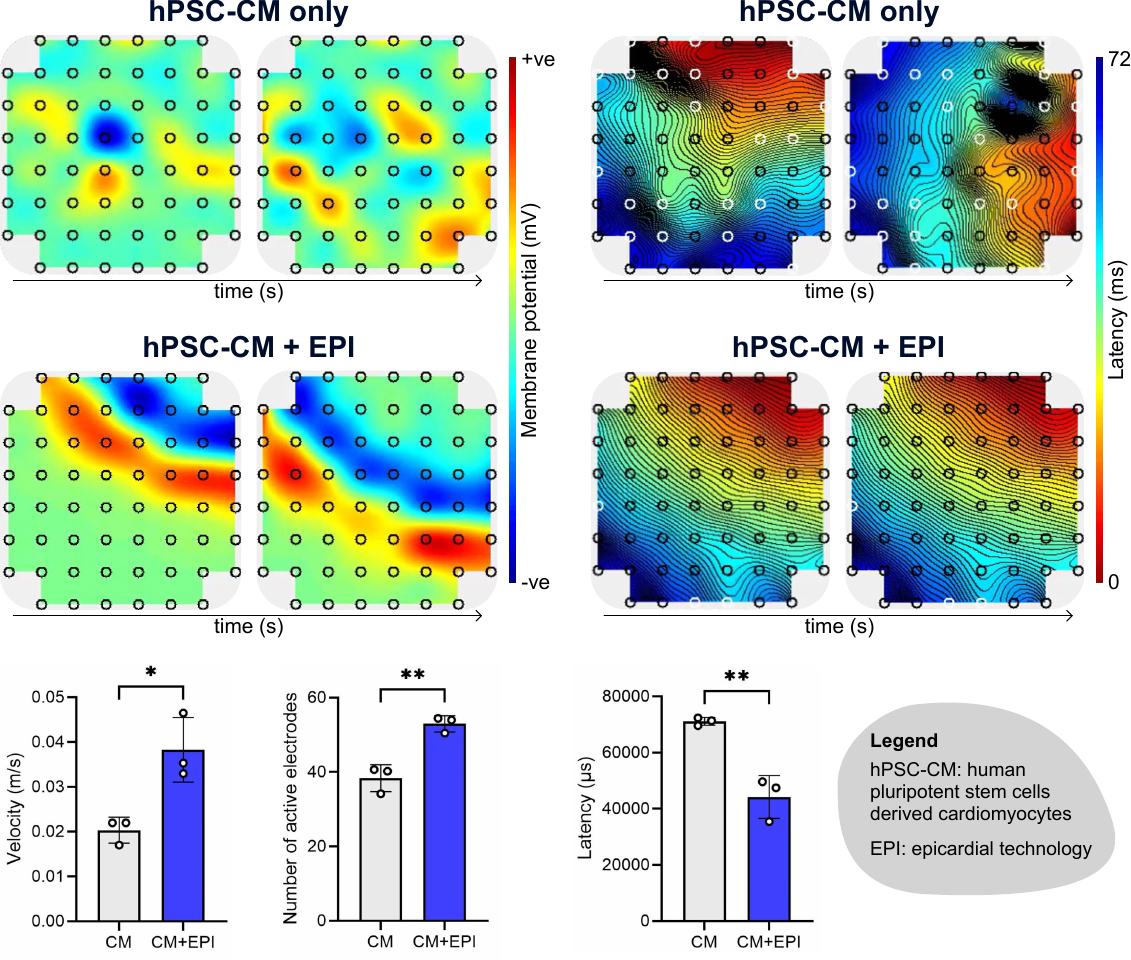 EPI product data - improved velocity, active electrodes and latency with EPI
