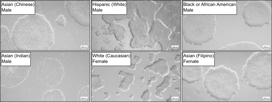 Ready to order hiPSCs - representative colonies