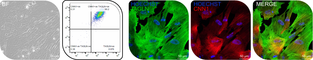 Neural crest-derived SMCs